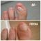 Как восстановить здоровый вид ногтей